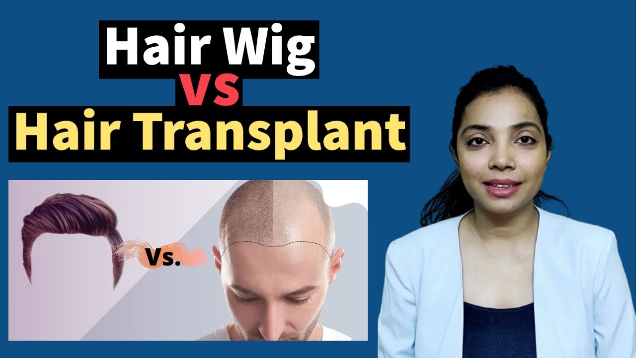 Hair Wigs VS Hair Transplant, Which One Is Better