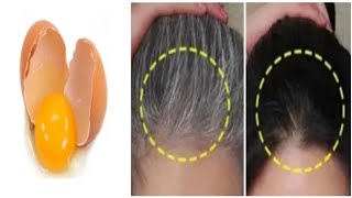 Gray Hair Turn To Black Hair Naturally Permanently In 6 Minutes | Gray Hair Dye Naturally With Egg