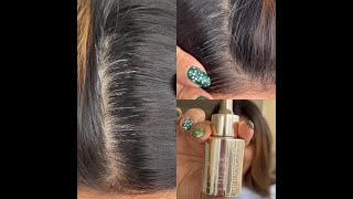 Can Gray Hair Go Away? Let'S Test Out The Vegamour Gro Ageless Anti-Gray Hair Serum Part 1