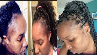 How To Grow Your Edges Back While Your Hair Is In Braids:Rice Water Hair Routine