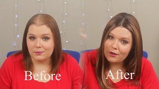 Uniwigs Hope Synthetic Topper Review|For Hair Loss