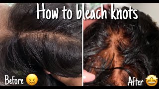 How To Bleach Knots On Hd Closure | Dare To Have Hair