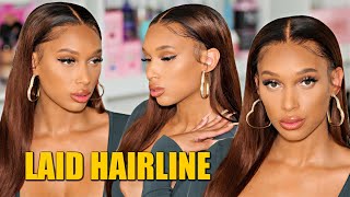  Super Pre-Plucked Hairline: How To Properly Apply A Lace Wig With Thinner Hairline