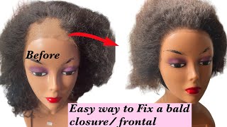 Easy Way To  Fix A Bald Closure / Frontal... Diy How To Fix A Bald Closure And Frontal