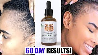 Easy Tip How To Grow Back Your Edges & Natural Hair In 2 Months!