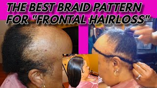 The Best Sew-In Weave Braid Pattern For Frontal Hairloss