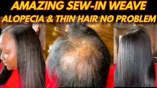 Amazing Sew In Weave With Alopecia, Hair Loss, & Thin Hair