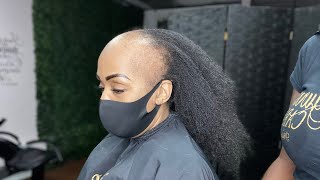She Never Thought She Could Achieve This Style, With So Much Hair Loss.