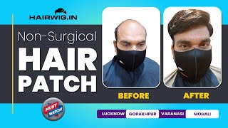 Hair Patch | Clip System | Pinki Singh | Hairwig.In | #Gorakhpur  #Trending #Viral