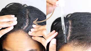 How To Remove Hair Bonding Glue/ Glue-In Weaves With No Damage! | Beauty On A Budget!