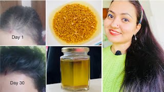 Winter Hair Growth Transformation Challenge To Regrow Lost Hair|Khoye Hue Baal Vaaps Ugaane Kaa Acuu
