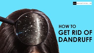 How To Get Rid Of Dandruff Permanently | Easy At-Home Hair Care Routine | Be Beautiful