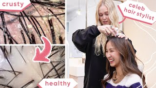 Simple Tips For Dandruff, Itchy Scalp & Hair Loss (With Celeb Hair Stylist)