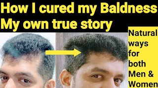 Munnn Nerrrriyil Mutti Eerri Konnttee Celkirrtaa?Hair Growth Tips For Forehead In Tamil/Stop Hairfal