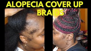 Detailed Alopecia Cover Up Braided Hairstyle