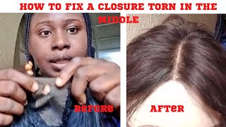 How To Fix/ Repair Torn Or Ripped Lace Closure/Simple And Easy