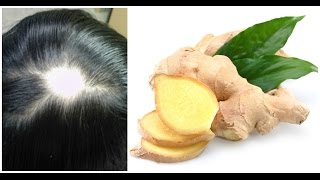 Ginger Juice To Cure Baldness & Regrow New Hair | Sushmita'S Diaries