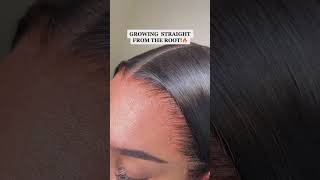 Growth Hd Thin Hairline Pre Plucked Hd Full Lace Wig Human Hair Glueless / Yoowigs