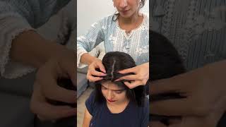 Cover Thinning Scalp With Nish Hair Volume Hair Topper For Women | Hair Toppers India