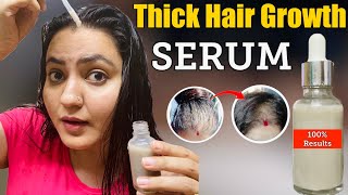 Diy Thick Hair Growth Serum : Ghr Pr Hlke Baalon Ko Kren Ghnaa 100%, Ugaaen Hairline, Bald Patches