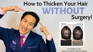 How To Treat Your Thinning Hair Holistically And Thicken It Without Surgery - Dr. Anthony Youn