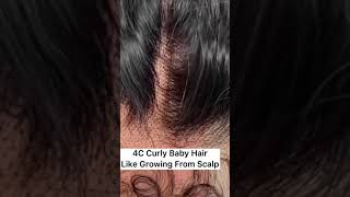 Hair Tutorial | 4C Curly Baby Hair Like Growing From Scalp #Shorts #Hairtutorial #Hairtips