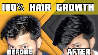 Best Hair Growth Technique | It Follow Pnnnnaa Knnttippaa Mutti Vllrum | Tamil | Shadhik Azeez