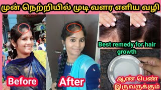 Forehead Hair Growth Natural Remedy At Home| Munnn Nerrrriyil Mutti Vllr | Vlllukkai Tlaiyil Mutti V